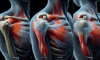 Acupuncture Techniques for Frozen Shoulder Relief Explained
