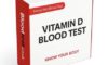 Vitamin D Blood Test: Essential Guide for Brighton Residents